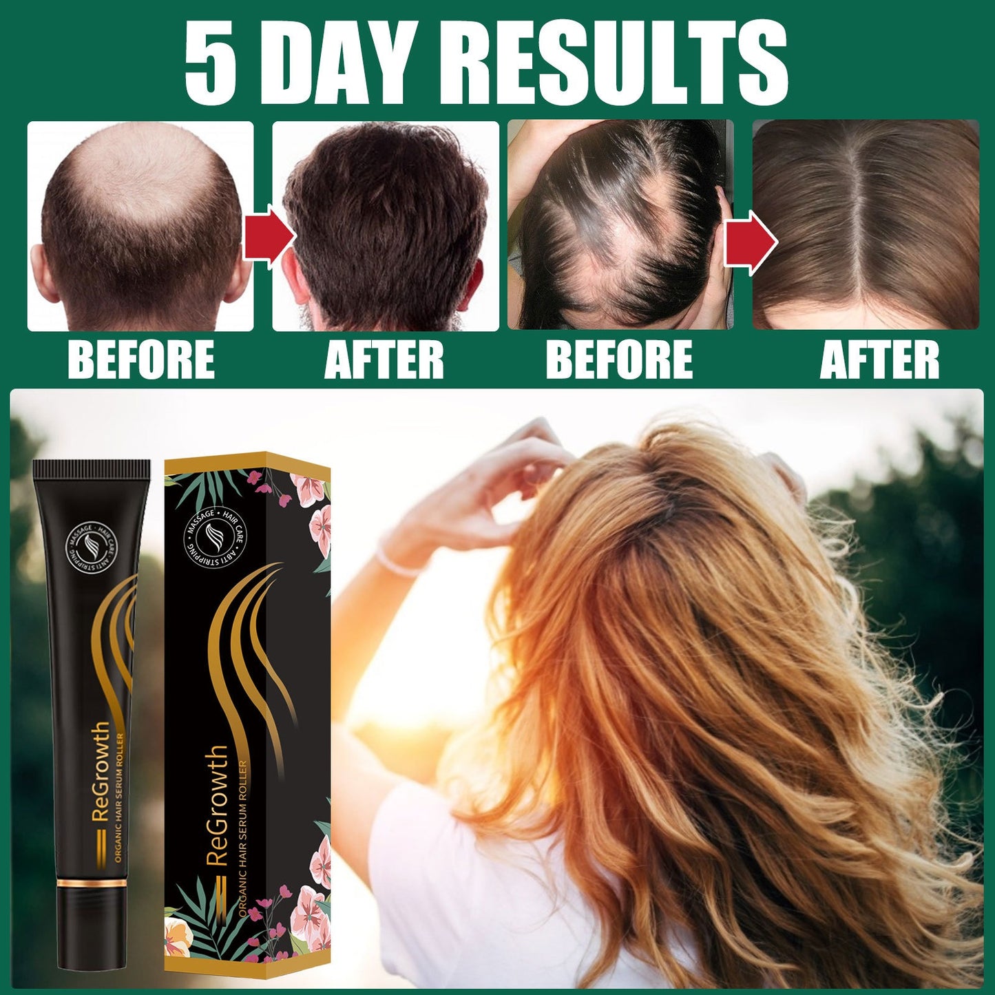 Organic Hair Regrowth Serum Roller Set – Anti Hair Loss Treatment & Scalp Nourishing Formula