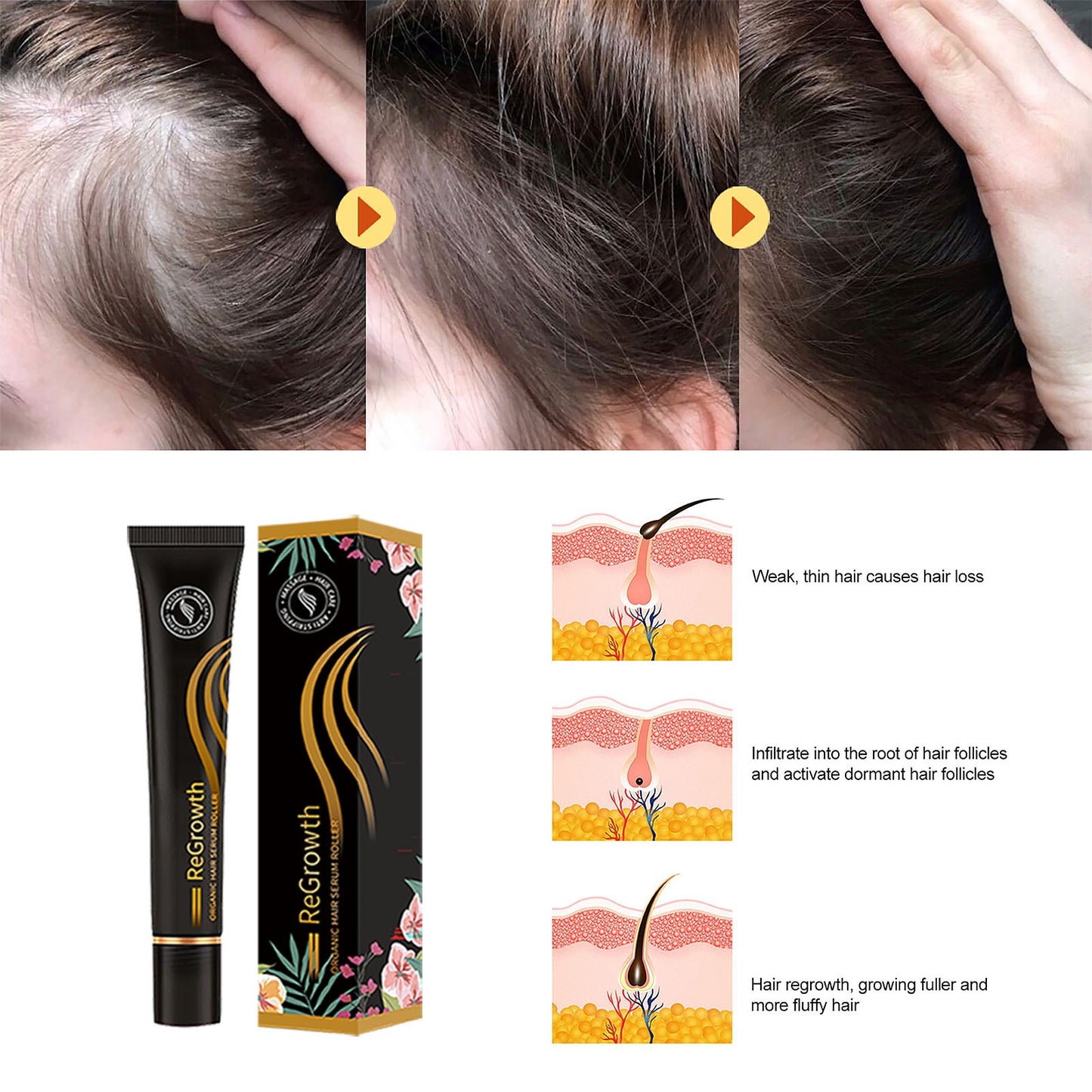 Organic Hair Regrowth Serum Roller Set – Anti Hair Loss Treatment & Scalp Nourishing Formula