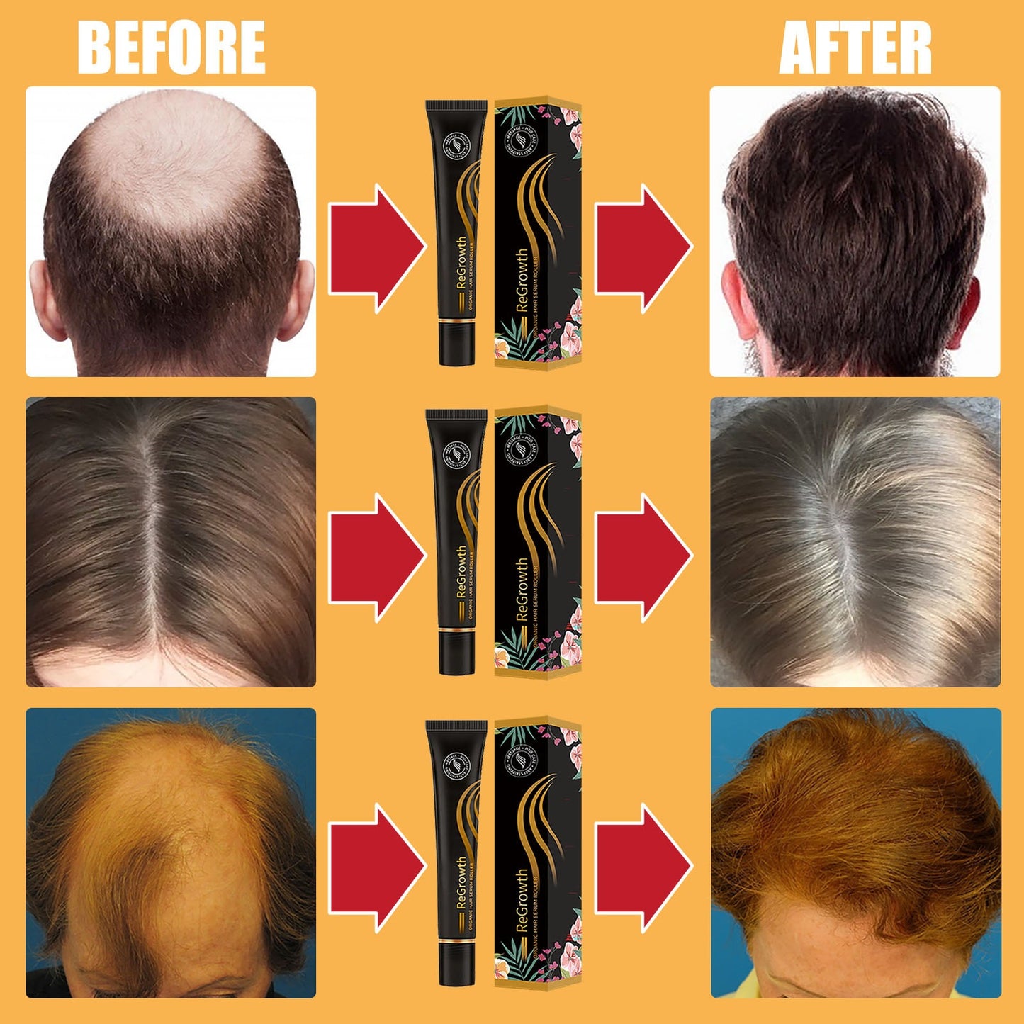 Organic Hair Regrowth Serum Roller Set – Anti Hair Loss Treatment & Scalp Nourishing Formula