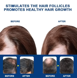 Sumifun Hair Growth Cream – Anti Hair Loss, Hair Regrowth & Thicker Hair Treatment for Strong, Healthy Hair